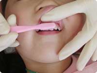 前歯（表側）の磨き方